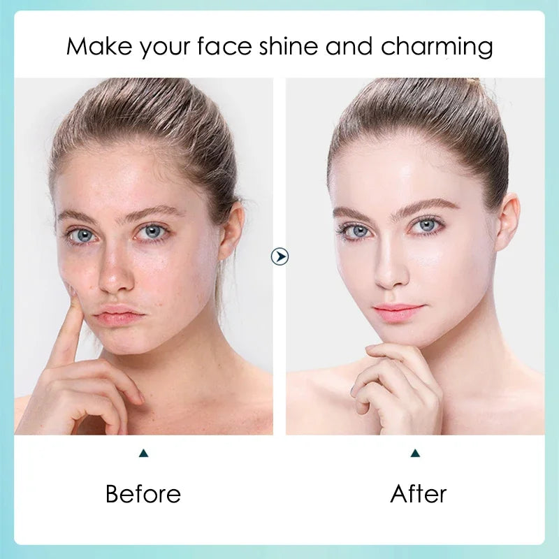 Hyaluronic Facial Mask - Hydrating, Moisturizing and Pore Care (10pcs)