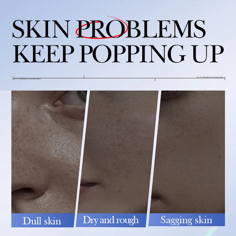 5pcs SADOER Caviar Hyaluronic Acid Facial Masks - Moisturizing and Brightening