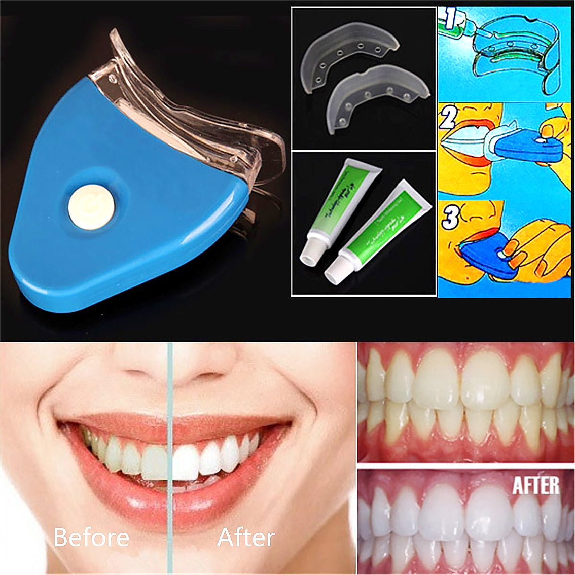 Teeth Whitening Gel with LED – Oral Dental Bleaching Whitener