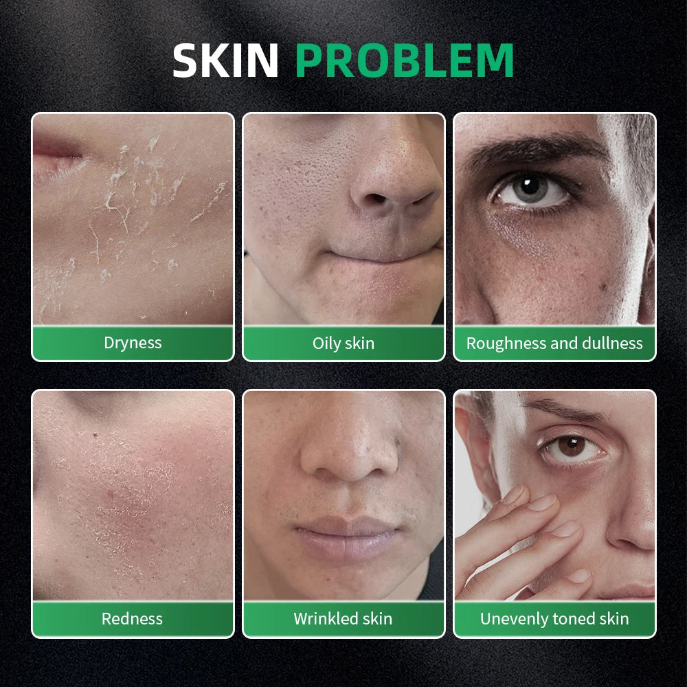 Men’s Skincare Kit Oil Control Moisturizing Exfoliating and Firming