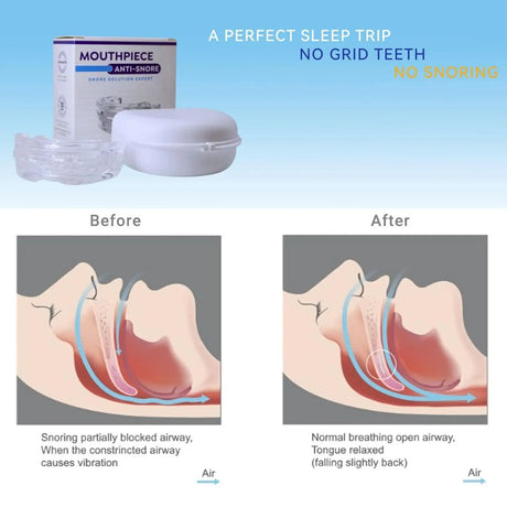 Adjustable Anti Snoring Mouth Guard for Snoring and Bruxism
